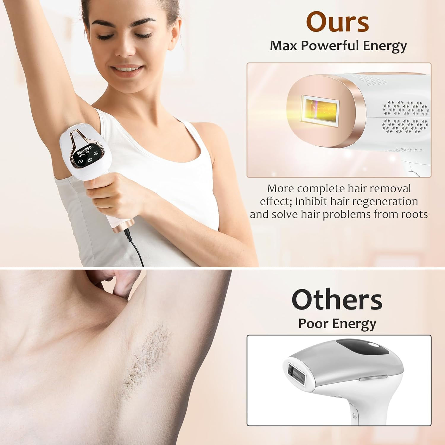 Ipl Hair Removal Laser Epilato - Opt Ipl Laser Hair Removal Machine recension och pris