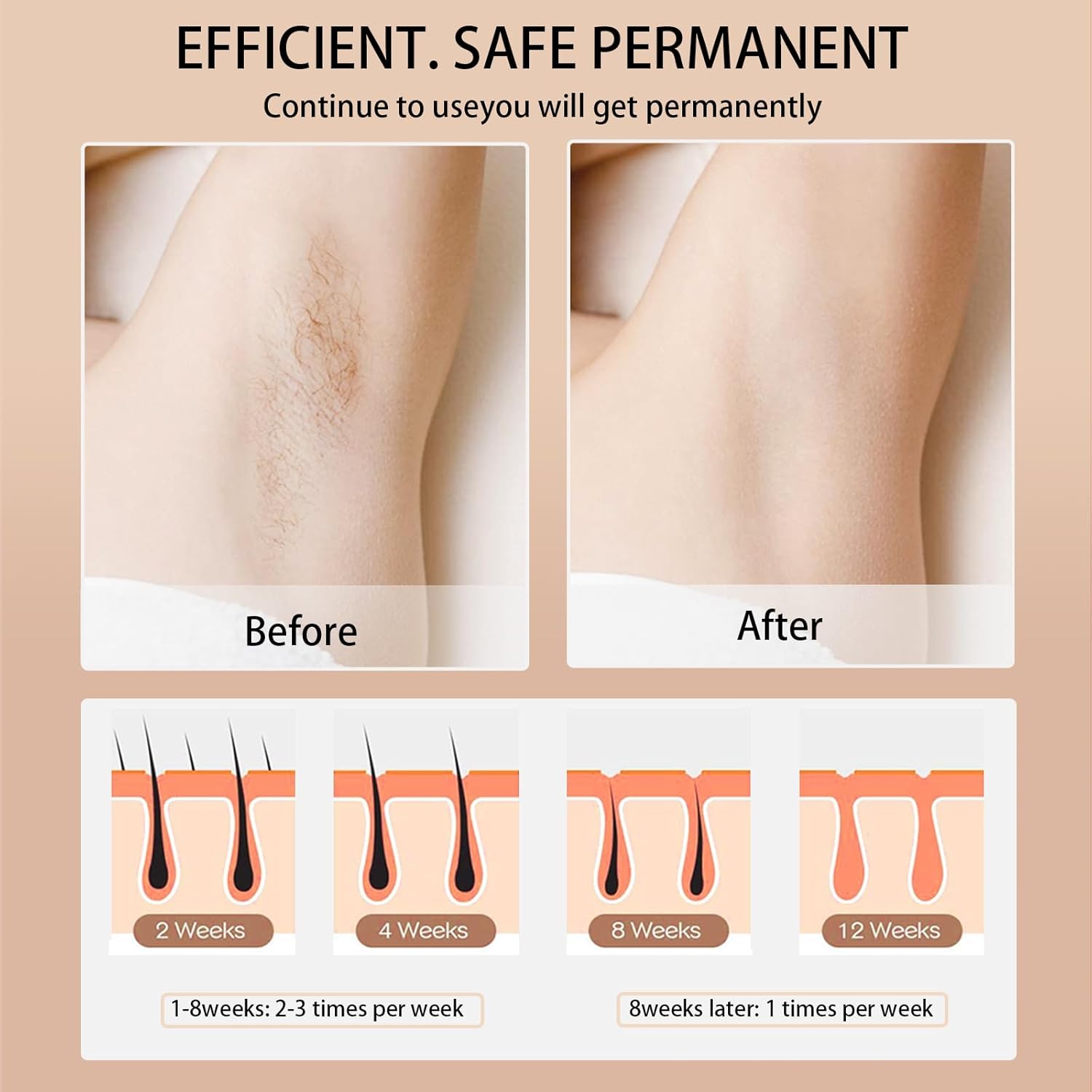 Ipl Hair Removal Laser Epilato - Opt Ipl Laser Hair Removal Machine recension och pris