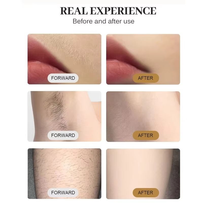 808nm Diode Laser Hair Removal - Cooling Gel For Laser Hair Removal recension och pris