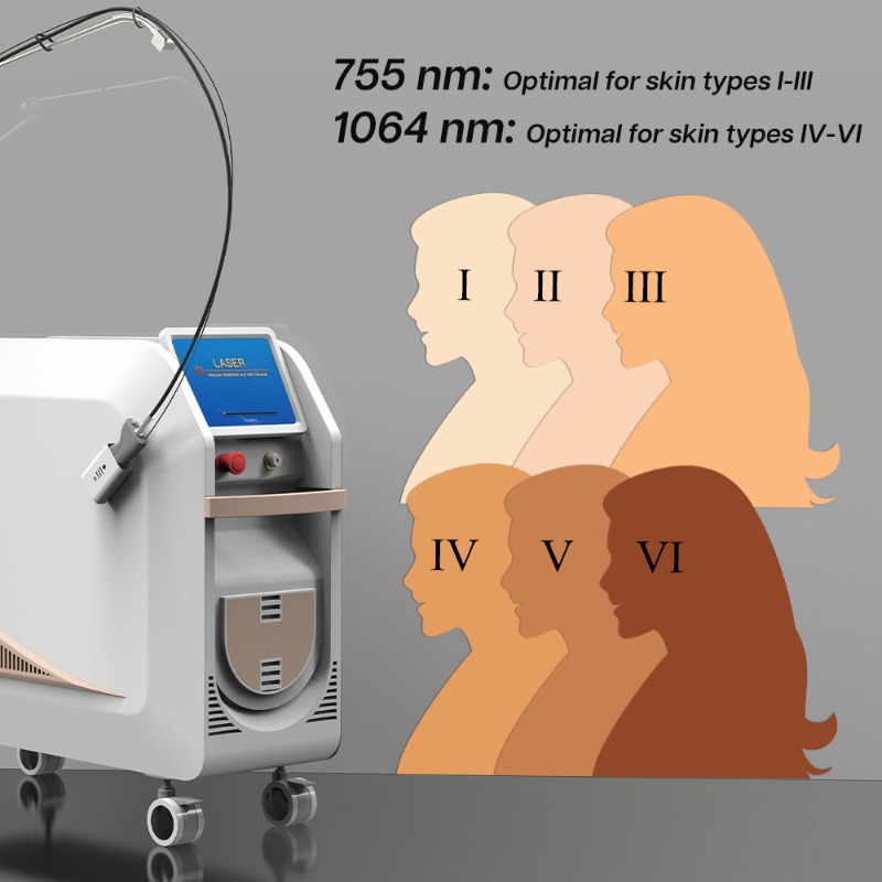 1064Nm Long Pulse Nd Yag Laser - Alexandrite Laser Hair Removal Machine recension och pris