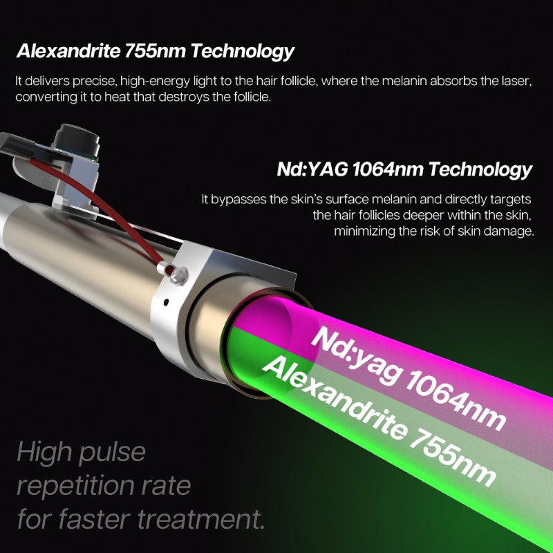 1064Nm Long Pulse Nd Yag Laser - Alexandrite Laser Hair Removal Machine recension och pris