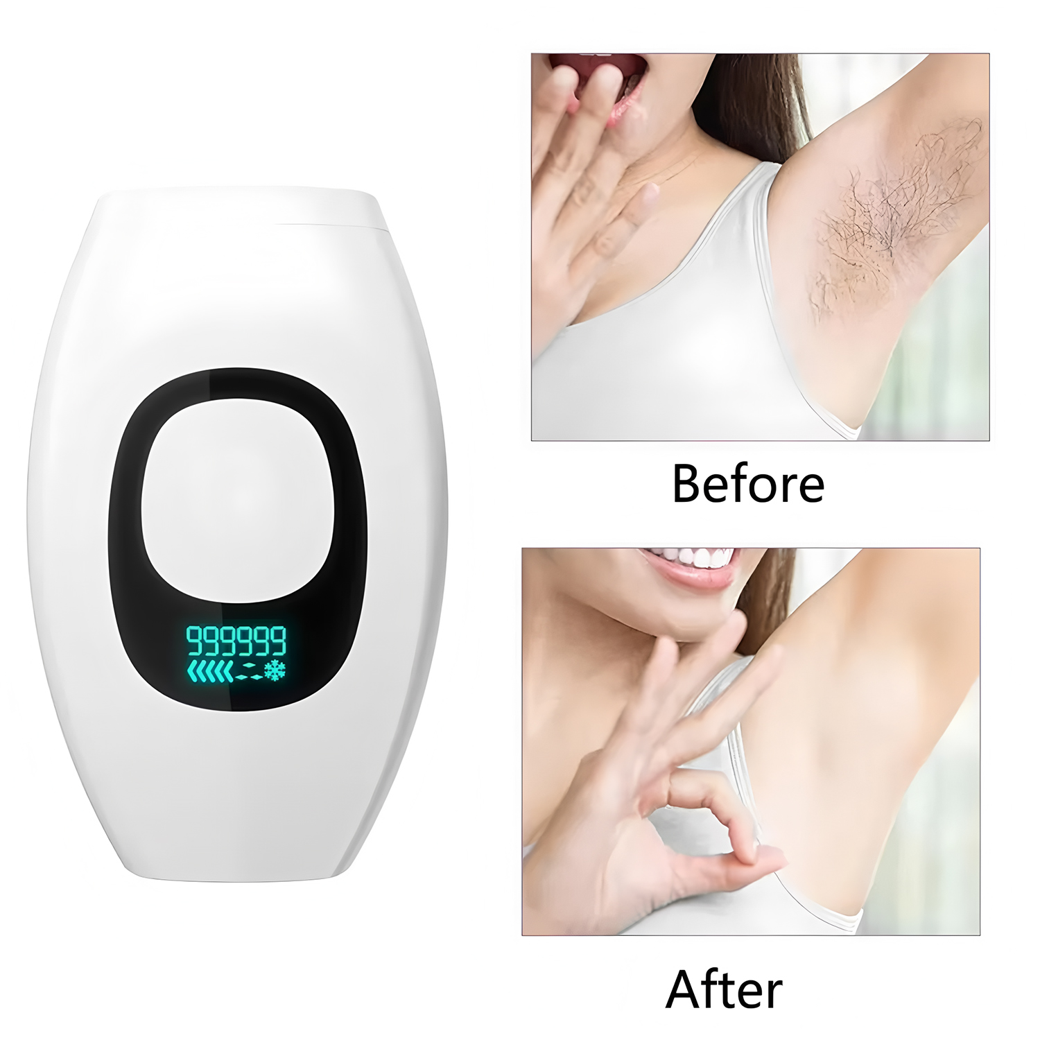 Digital Display IPL 500,000 Fl - Opt Ipl Laser Hair Removal Machine recension och pris