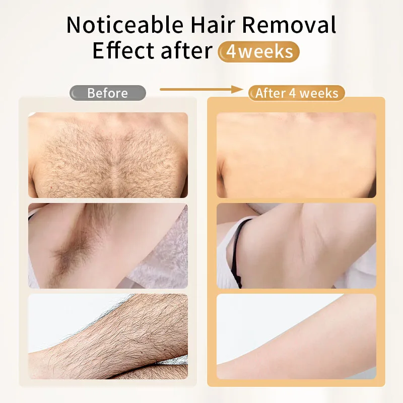FOR T001 48W Laser Hair Remova - Ipl Hair Removal Handset Permanent recension och pris