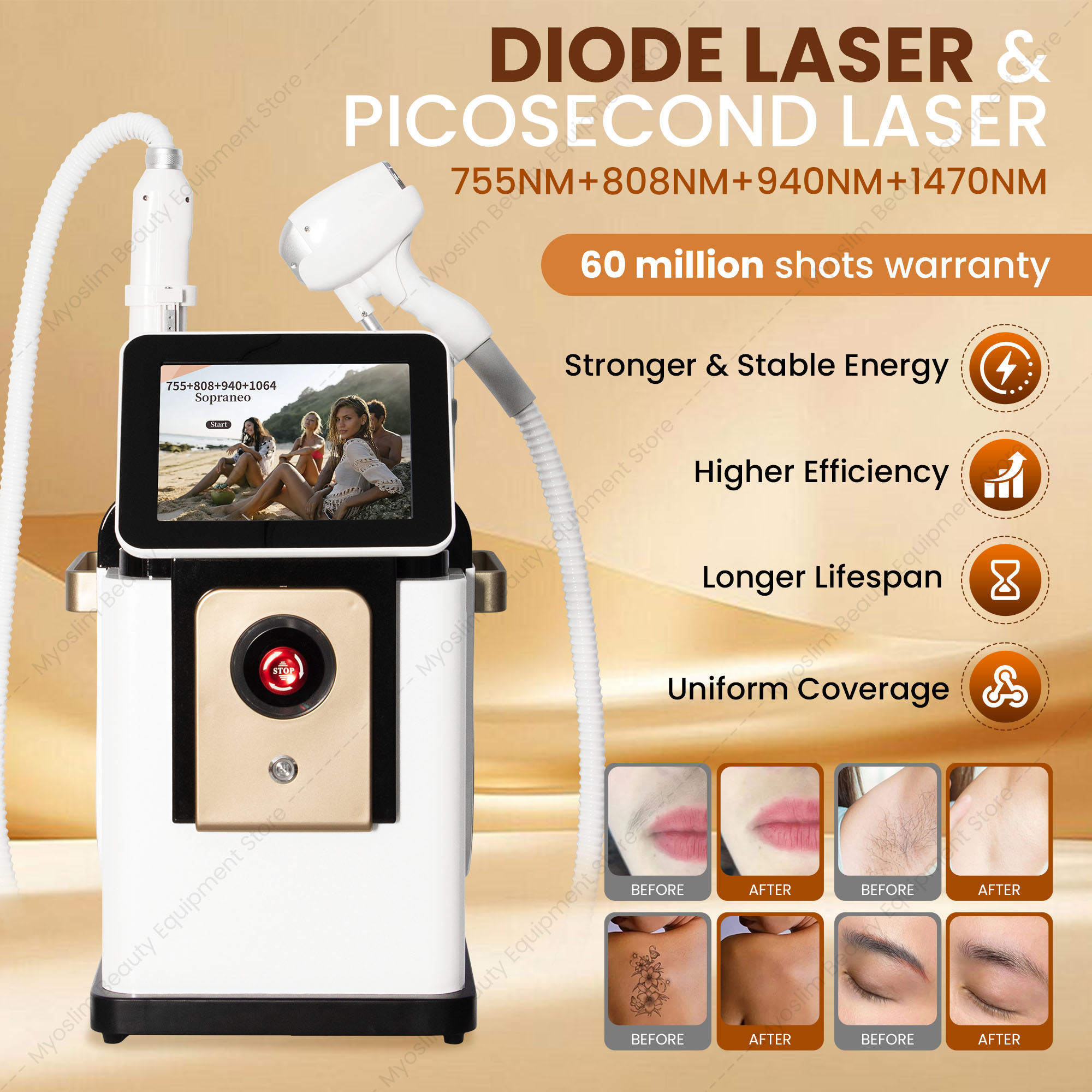 Two-in-One 755nm 808nm 810nm 8 - Diode Laser Hair Removal 808Nm 755Nm 1064Nm recension och pris