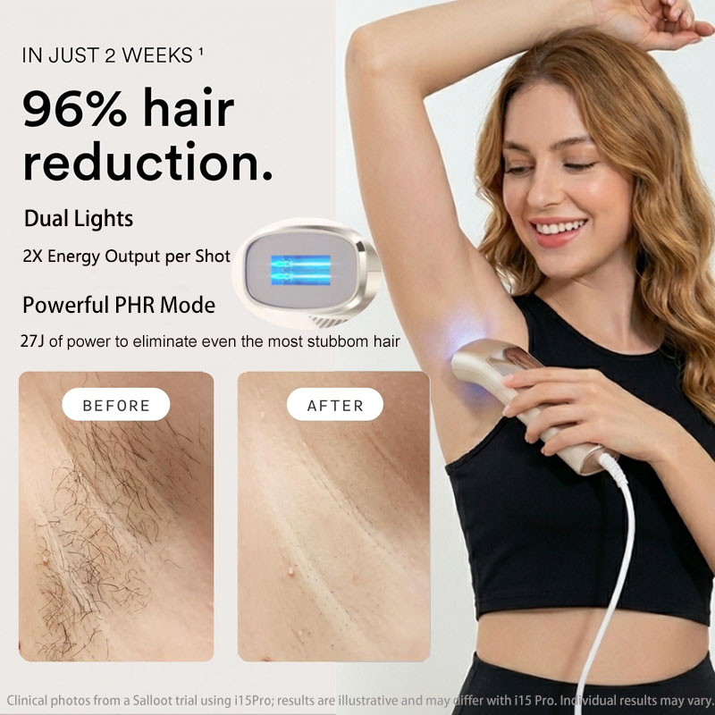 Trinity I15 Pro Sapphire Ice C - Home Ipl Hair Removal Sapphire Cooling recension och pris