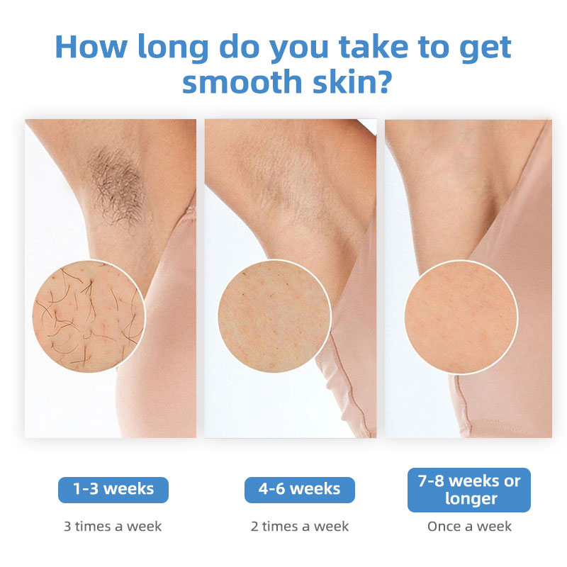 IShine Sapphire Ice Cooling IP - Home Ipl Hair Removal Sapphire Cooling recension och pris
