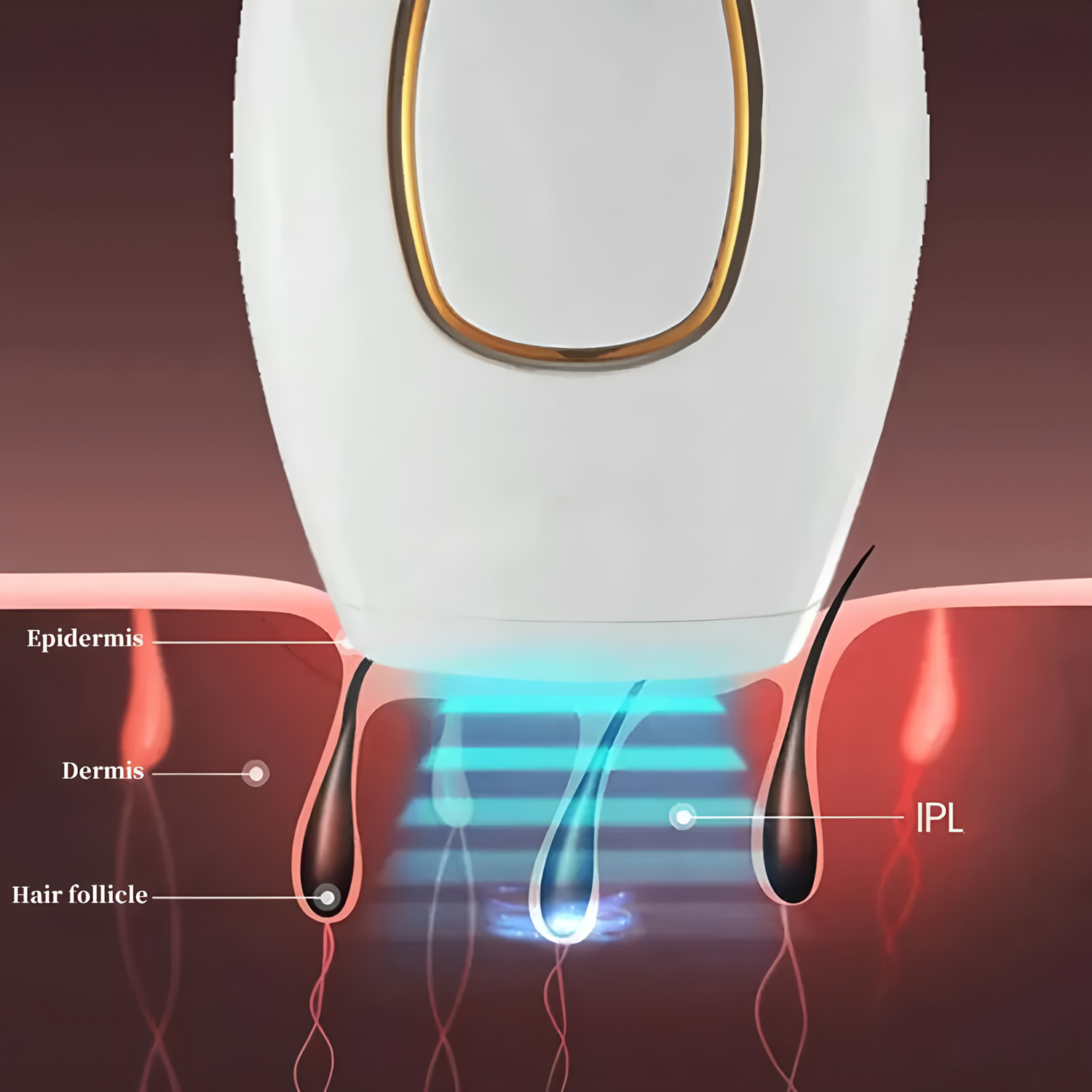 Laser Epilator IPL Hair Remova - Opt Ipl Laser Hair Removal Machine recension och pris